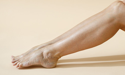 Treatment For Leg Veins